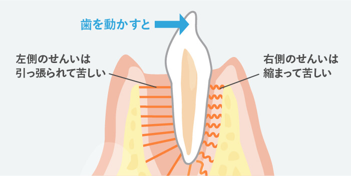 矯正装置の装着