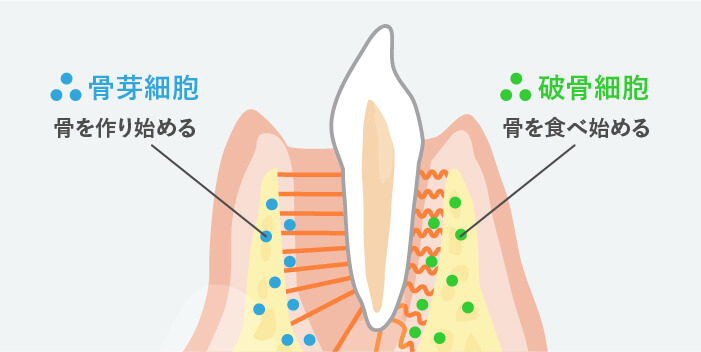 歯の動きはじめ