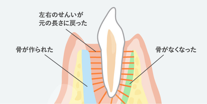歯の移動