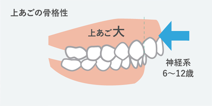 上あごの成長が大きすぎる方