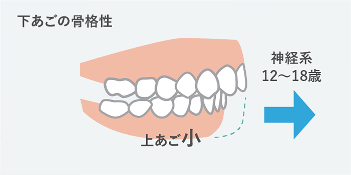 下あごの成長が小さすぎる方