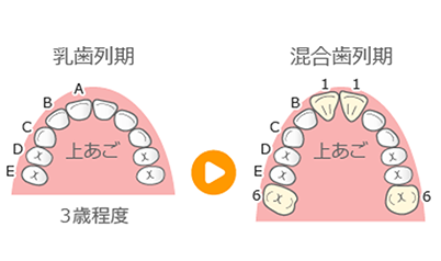 Ⅰ期治療